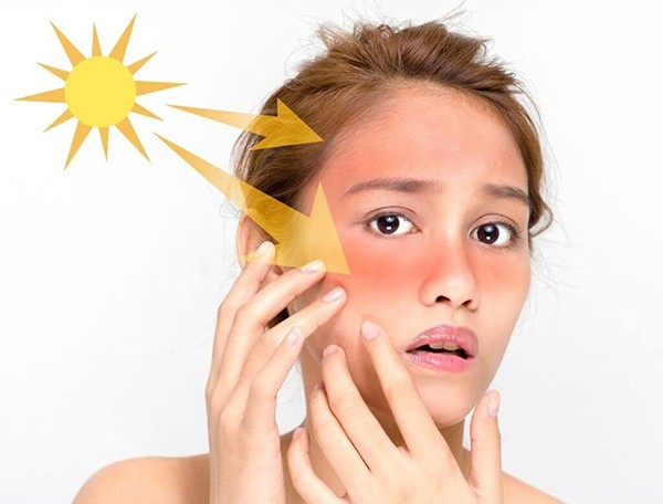 Tia UV từ ánh nắng mặt trời là một trong những tác nhân gây ra tàn nhang