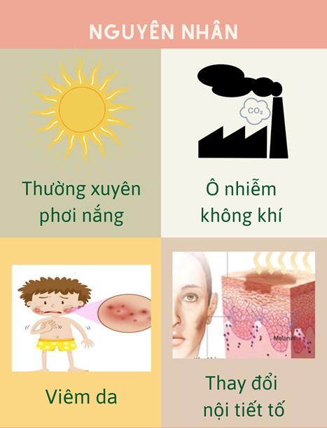 Những nguyên nhân khiến da không đều màu có thể do thường xuyên phơi nắng, thay đổi nội tiết tố,...
