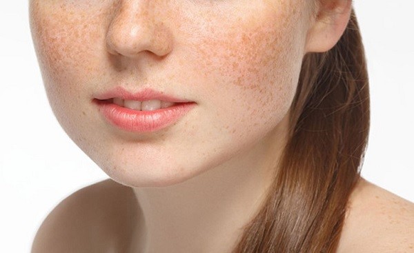 Nám hỗn hợp có thể ảnh hưởng đến sức khỏe và tình trạng làn da như thế nào? 
