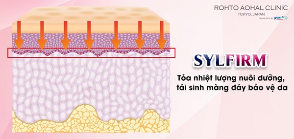 Phương pháp phi kim xung tần số vô tuyến Sylfirm giúp tái sinh màng đáy bảo vệ da