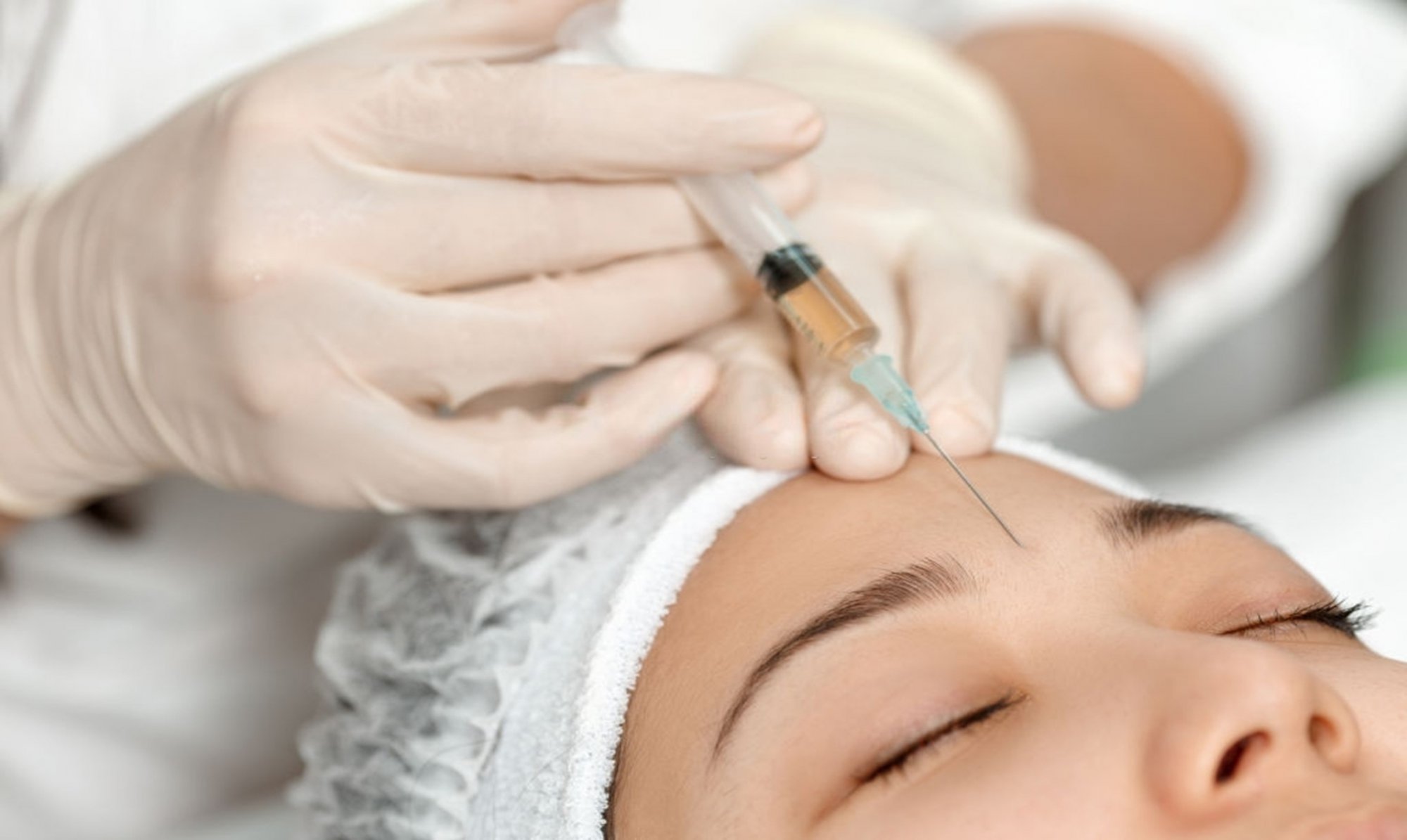 Botox là gì? Những thông tin cần biết về phương pháp xóa nếp nhăn, trẻ hóa da mặt