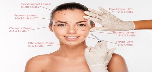 Fillers and Botox injection cost depend on many factors 
