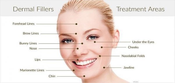 Fillers effects on each area on face