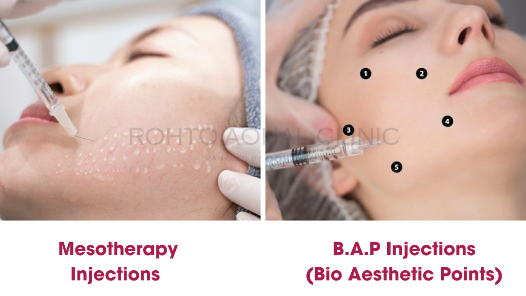 4. Lợi Ích Của Tiêm Mesotherapy